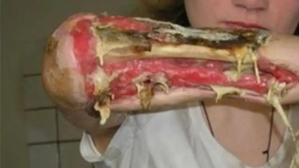 Krokodil